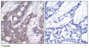 Anti-STMN1 Rabbit Polyclonal Antibody