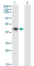 Anti-ASB9 Mouse Monoclonal Antibody [clone: 1D8]