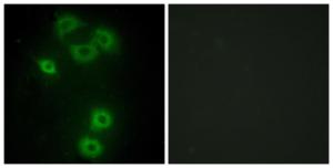 Immunofluorescence analysis of A549 cells using Anti-BMX Antibody. The right hand panel represents a negative control, where the antibody was pre-incubated with the immunising peptide