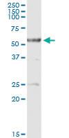 Anti-ALDH3A2 Rabbit Polyclonal Antibody