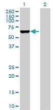 Anti-GAD1 Rabbit Polyclonal Antibody