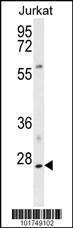 Anti-APOBEC3A Rabbit Polyclonal Antibody (Biotin)