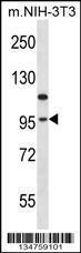 Anti-EEF2K Rabbit Polyclonal Antibody (APC (Allophycocyanin))