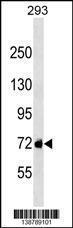 Anti-GG8L2 Rabbit Polyclonal Antibody (HRP (Horseradish Peroxidase))