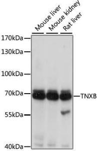 Antibody anti-TNXB 100 µl