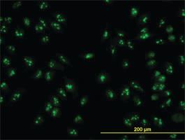 Anti-NOP16 Mouse Monoclonal Antibody [clone: 1G4]