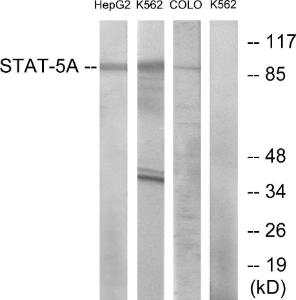 Western blot analysis of lysates from HepG K56 and COLO cells using Anti-STAT5A Antibody. The right hand lane represents a negative control, where the antibody is blocked by the immunising peptide