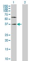 Anti-PVR Rabbit Polyclonal Antibody