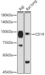 Western blot analysis of extracts of various cell lines, using Anti-CD19 Antibody (A9058) at 1:1,000 dilution. The secondary antibody was Goat Anti-Rabbit IgG H&L Antibody (HRP) at 1:10,000 dilution.