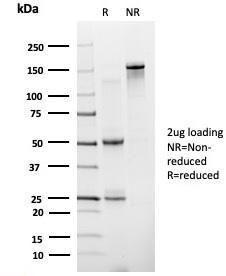 SDS-PAGE analysis of Anti-ZNF81 Antibody [PCRP-ZNF81-2G2] under non-reduced and reduced conditions; showing intact IgG and intact heavy and light chains, respectively. SDS-PAGE analysis confirms the integrity and purity of the antibody