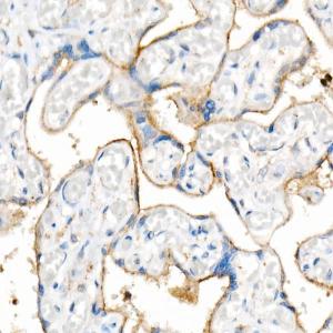 Western blot analysis of extracts from wild type(WT) and CD63 knockout (KO) 293T cells, using Anti-CD63 Antibody [ARC51703] (A305333) at 1:500 dilution. The secondary antibody was Goat Anti-Rabbit IgG H&L Antibody (HRP) at 1:10,000 dilution.