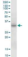 Anti-MPST Mouse Polyclonal Antibody