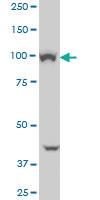 Anti-VPS11 Mouse Monoclonal Antibody [clone: 1H1]