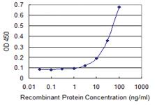 Anti-SRP68 Mouse Monoclonal Antibody [clone: 3A3]