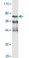 Anti-FGFR1OP Mouse Monoclonal Antibody [clone: 1E8]