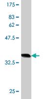 Anti-HMGXB4 Mouse Monoclonal Antibody [clone: 3B4]