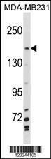 Anti-MYBBP1A Rabbit Polyclonal Antibody (APC (Allophycocyanin))