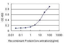 Anti-NOP16 Mouse Monoclonal Antibody [clone: 1G4]