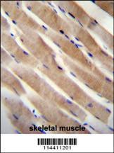 Anti-RHEB Rabbit Polyclonal Antibody