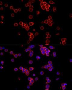 Immunofluorescence analysis of Raji cells using Anti-CD19 Antibody (A9058) at a dilution of 1:100 (40x lens). DAPI was used to stain the cell nuclei (blue).