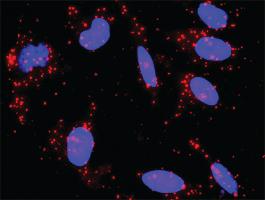 Anti-CREB3 + CREB3L4 Antibody Pair