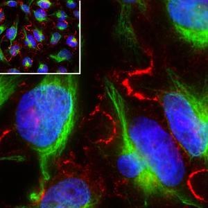 Immunofluorescent analysis of HeLa cell culture stained using Anti-MARCKS Antibody [5F9] (A270556), at a dilution of 1:1,000, in red