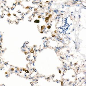 Immunohistochemistry analysis of paraffin-embedded human placenta using Anti-CD63 Antibody [ARC51703] (A305333) at a dilution of 1:200 (40x lens). Perform high pressure antigen retrieval with 10 mM citrate buffer pH 6.0 before commencing with IHC staining protocol.