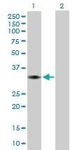 Anti-MPST Mouse Polyclonal Antibody