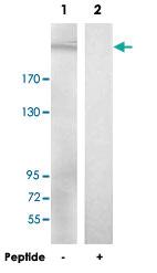 Anti-LAMB2 Rabbit Polyclonal Antibody