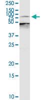 Anti-EZR Rabbit Polyclonal Antibody