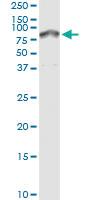 Anti-SERPIND1 Polyclonal Antibody Pair