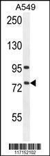 Anti-ALOX12B Rabbit Polyclonal Antibody (HRP (Horseradish Peroxidase))