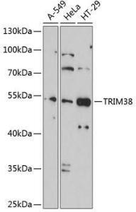 Western blot analysis of extracts of various cell lines, using Anti-TRIM38 Antibody (A9059) at 1:1,000 dilution The secondary antibody was Goat Anti-Rabbit IgG H&L Antibody (HRP) at 1:10,000 dilution Lysates/proteins were present at 25 µg per lane