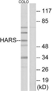 Antibody anti-HARS 100 µg