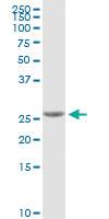 Anti-NOG Rabbit Polyclonal Antibody