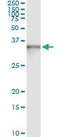 Anti-ASB9 Mouse Monoclonal Antibody [clone: 1D8]