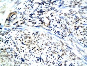 Anti-RAMP1 Rabbit Polyclonal Antibody