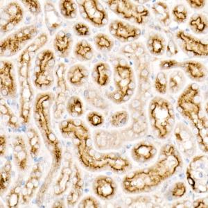 Immunohistochemistry analysis of paraffin-embedded rat lung using Anti-CD63 Antibody [ARC51703] (A305333) at a dilution of 1:200 (40x lens). Perform high pressure antigen retrieval with 10 mM citrate buffer pH 6.0 before commencing with IHC staining protocol.