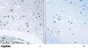 Anti-LAMC3 Rabbit Polyclonal Antibody