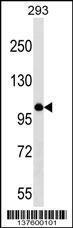 Anti-MYBL1 Rabbit Polyclonal Antibody (AP (Alkaline Phosphatase))