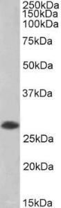 Antibody anti-april A83504-100 100 µg