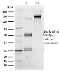 SDS-PAGE analysis of Anti-OCT-2 Antibody [Oct2/2137] under non-reduced and reduced conditions; showing intact IgG and intact heavy and light chains, respectively. SDS-PAGE analysis confirms the integrity and purity of the antibody.