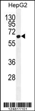 Anti-ZC3H12A Rabbit Polyclonal Antibody