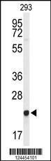 Anti-GGCT Rabbit Polyclonal Antibody (AP (Alkaline Phosphatase))