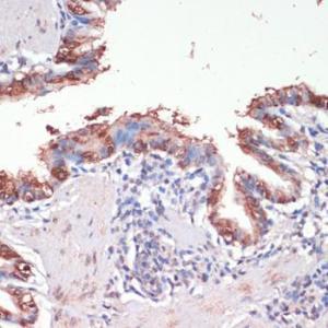 Immunohistochemistry analysis of paraffin-embedded rat lung using Anti-Musashi 1 / Msi1 Antibody (A9061) at a dilution of 1:200 (40x lens). Perform microwave antigen retrieval with 10 mM PBS buffer pH 7.2 before commencing with IHC staining protocol.