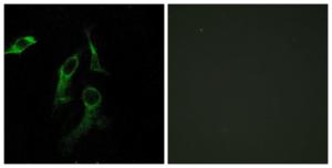 Antibody anti-HARS 100 µg