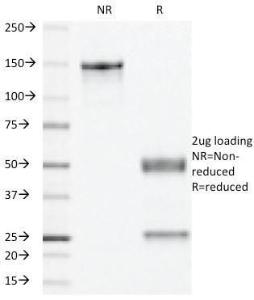 SDS-PAGE analysis of Anti-Progesterone Receptor Antibody [PR501] under non-reduced and reduced conditions; showing intact IgG and intact heavy and light chains, respectively. SDS-PAGE analysis confirms the integrity and purity of the antibody.