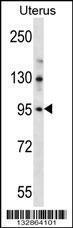 Anti-LRRC37B Rabbit Polyclonal Antibody (AP (Alkaline Phosphatase))