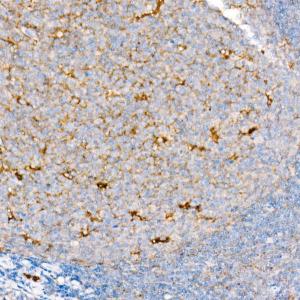 Immunohistochemistry analysis of paraffin-embedded mouse kidney using Anti-CD63 Antibody [ARC51703] (A305333) at a dilution of 1:200 (40x lens). Perform high pressure antigen retrieval with 10 mM citrate buffer pH 6.0 before commencing with IHC staining protocol.