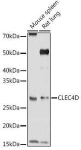 Anti-CLEC4D Antibody (A9074)